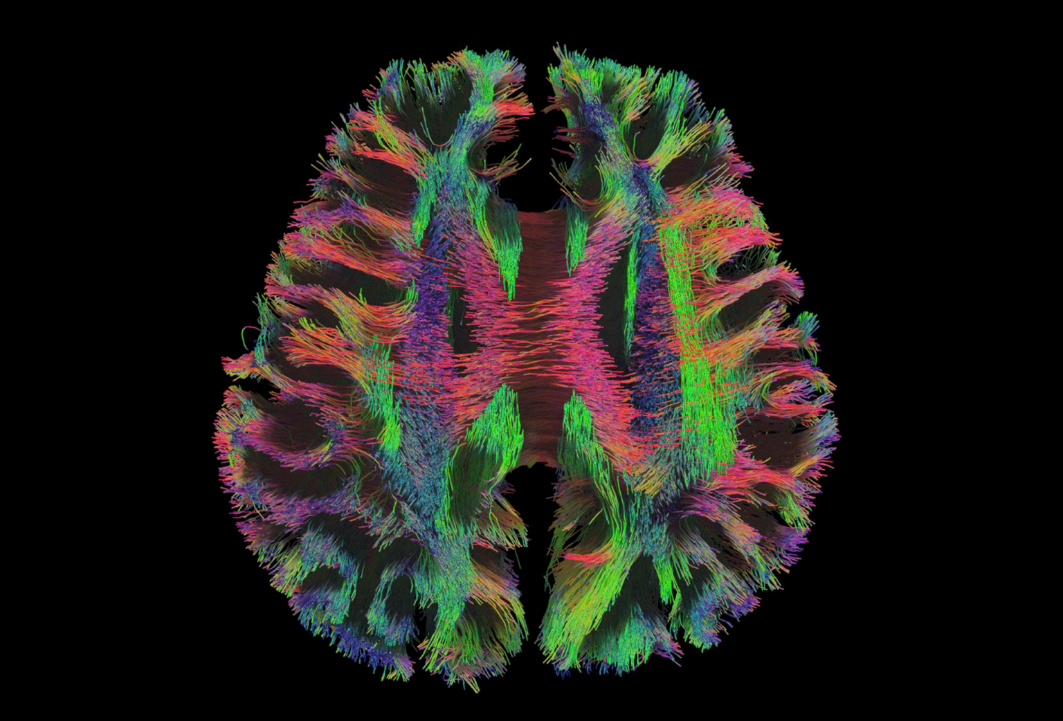 The Connectome 2.0 Scanner Captures the Brain in Unprecedented